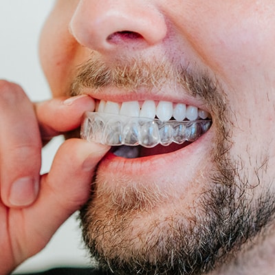 Invisalign Crescent Moon Orthodontics in Summerville Daniel Island SC