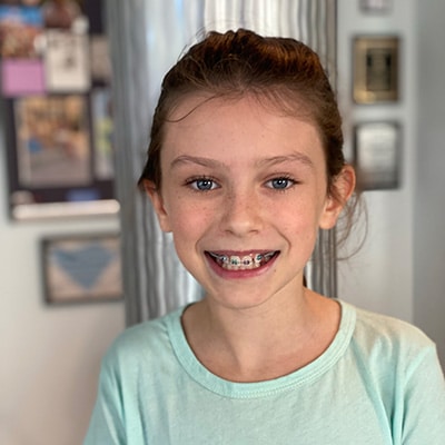 little girl with braces at Crescent Moon Orthodontics in Summerville Daniel Island SC